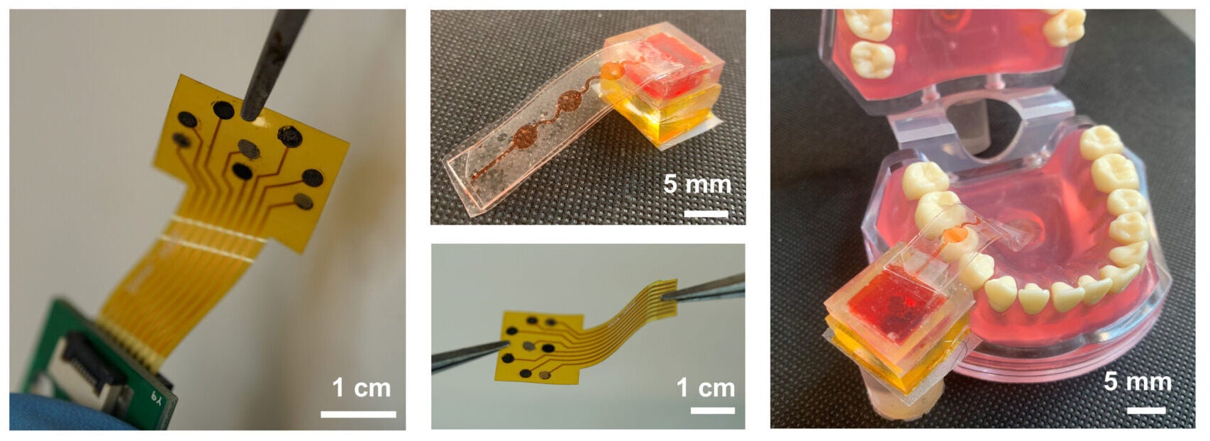 Photographs of a multichannel sensor patch and an EM actuator with colored liquid inside, mounted onto a dental cast.