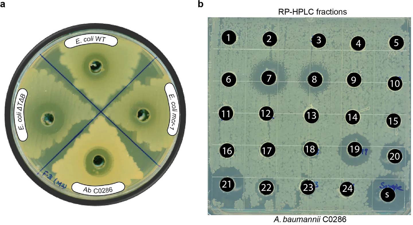 Historic Discovery Reveals New Weapon Against Drug-Resistant