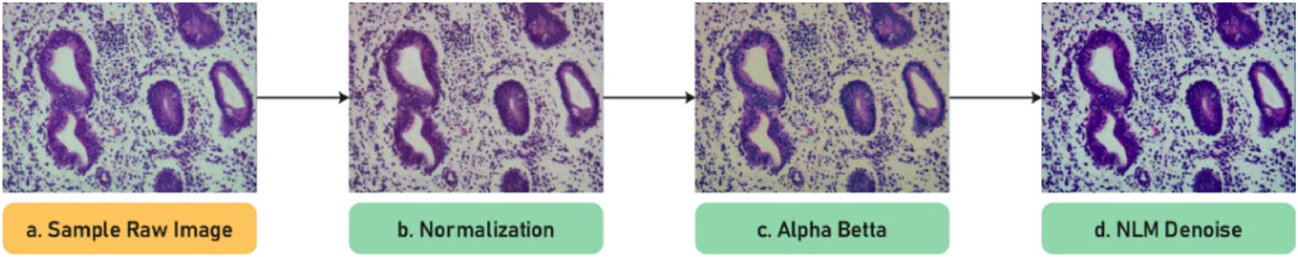 Image Preprocessing workflow.