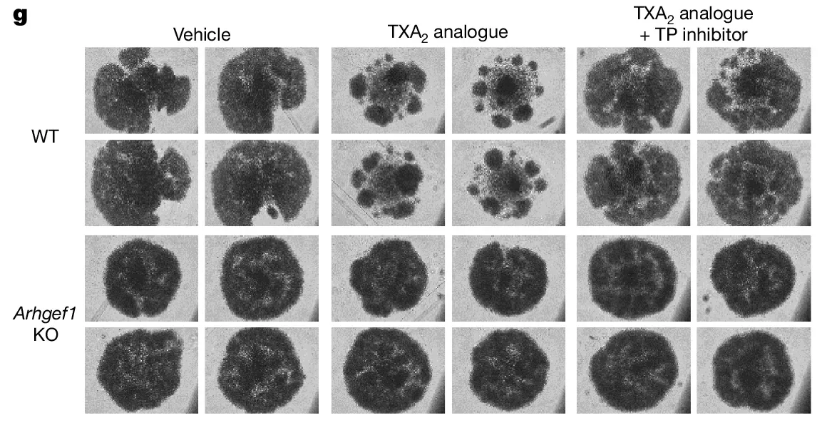 Photomicrographs of cells 5 days after stimulation of naive CD8+ T cells with anti-CD3/28 antibodies and rhIL-2 in the presence of TXA2 analogue U46619 or vehicle control, and treatment with the TXA2 receptor inhibitor.