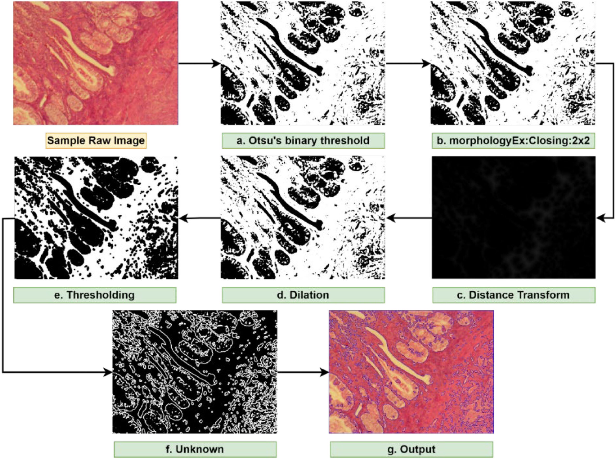 Steps of the watershed segmentation process. A method for segmenting images called the watershed algorithm, treats the image as a three-dimensional surface. 