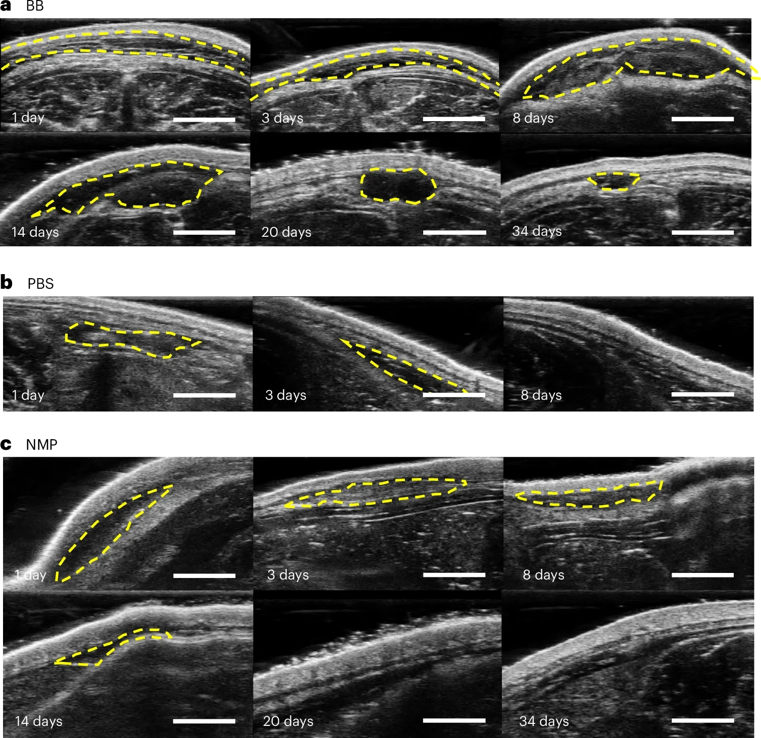 Ultrasound images depicting the clearance of BB within subcutaneous tissue over 34 days (a), PBS clearance over 8 days (b) and NMP clearance over 20 days (c). Yellow dashed circles indicate the contour of the injected solvent.