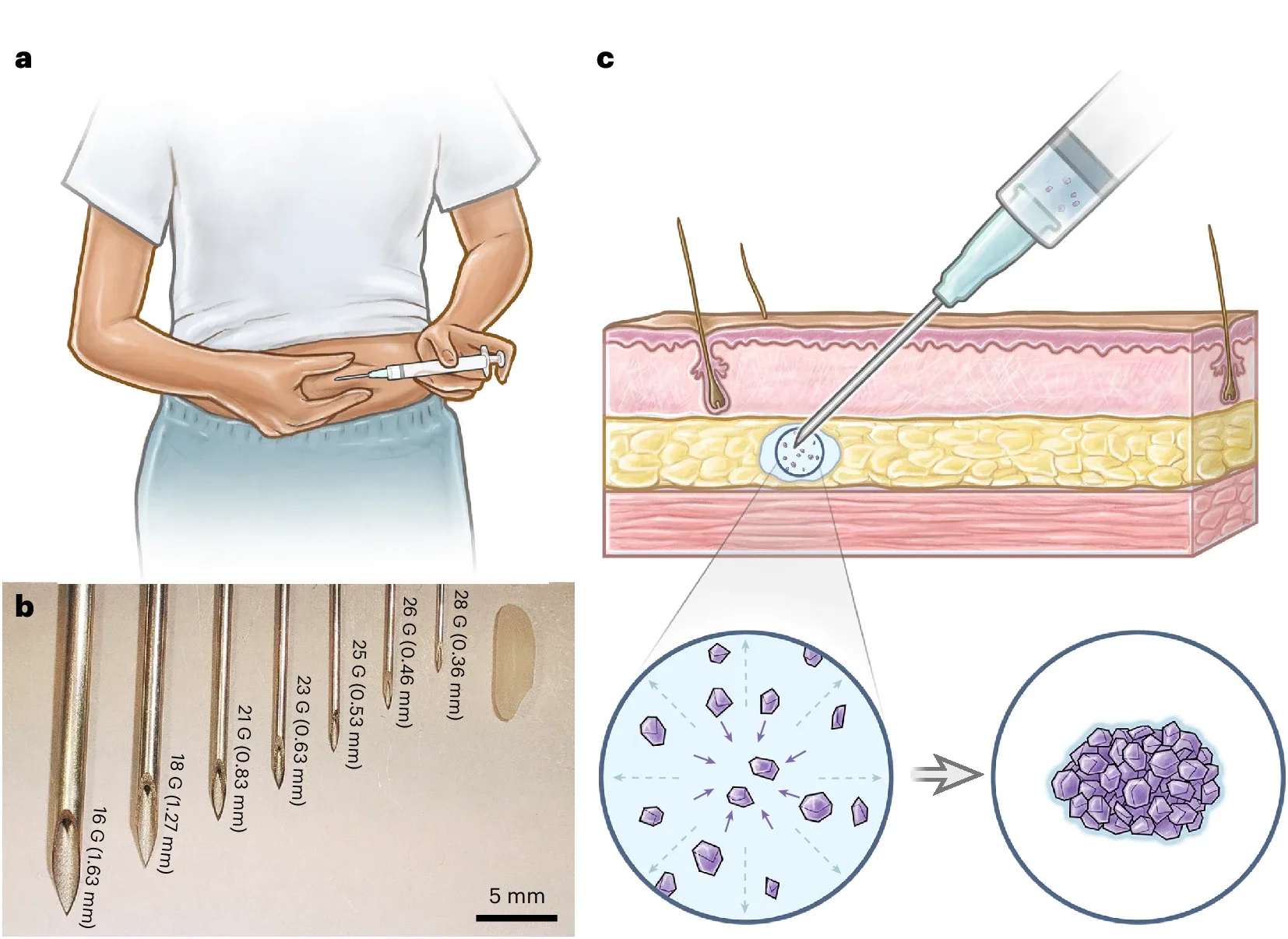 a, Schematic of the self-injection procedure. b, An image of different needle gauges ranging from 18 G to 28 G, compared against a grain of rice. c, Schematic of subcutaneous environment highlighting the solvent-exchange-driven self-aggregation of microcrystals into a compacted implant. Illustrations in a and c by Virginia E. Fulford, Alar Illustration.
