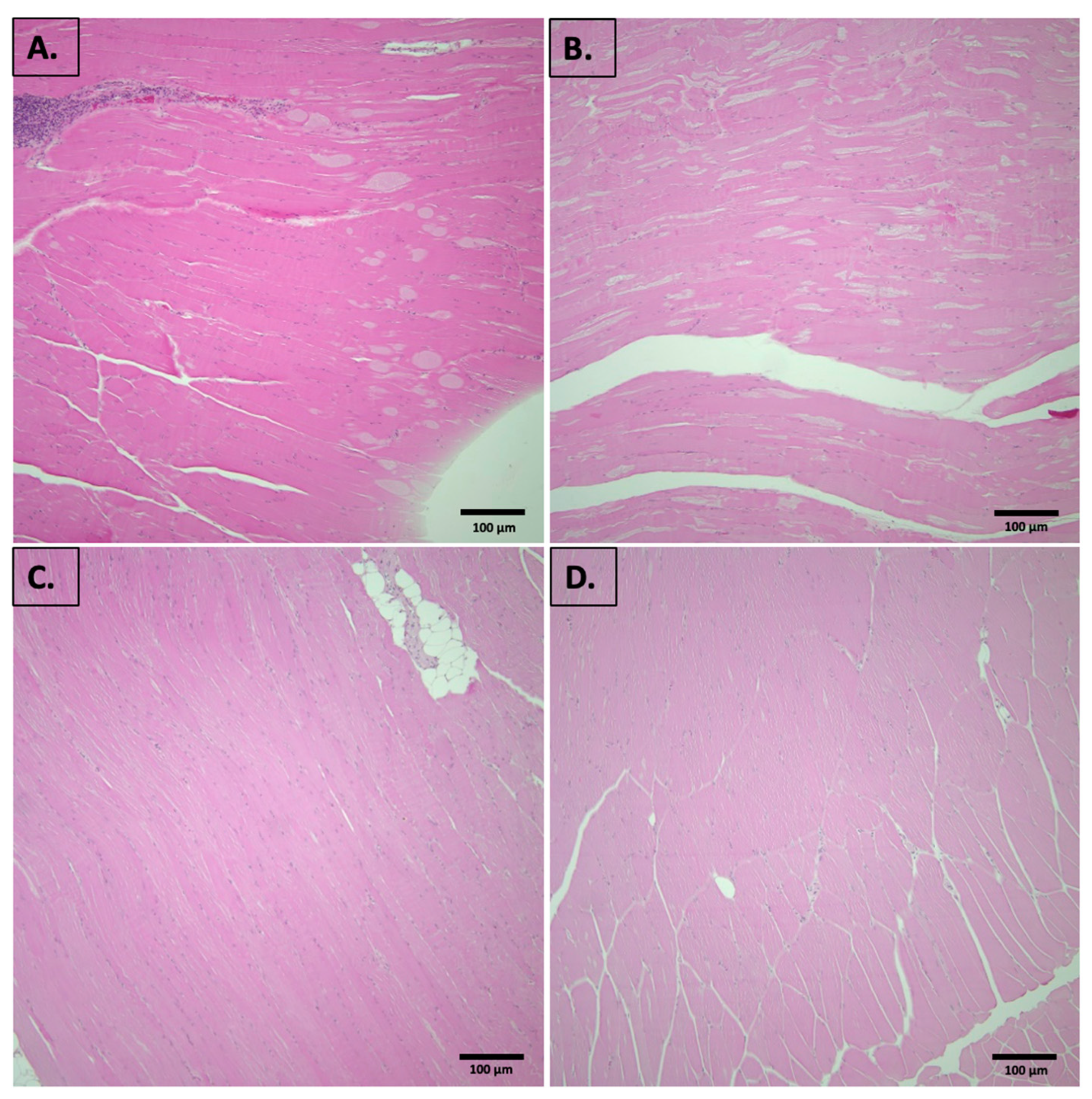 Representative images of mouse muscle from (A) male, SDM; (B) male, SDGM; (C) female, SDF; (D) female, SDGF. (A) represents chronic perivascular inflammation. (B–D) represent normal muscle histology with no significant pathological changes.