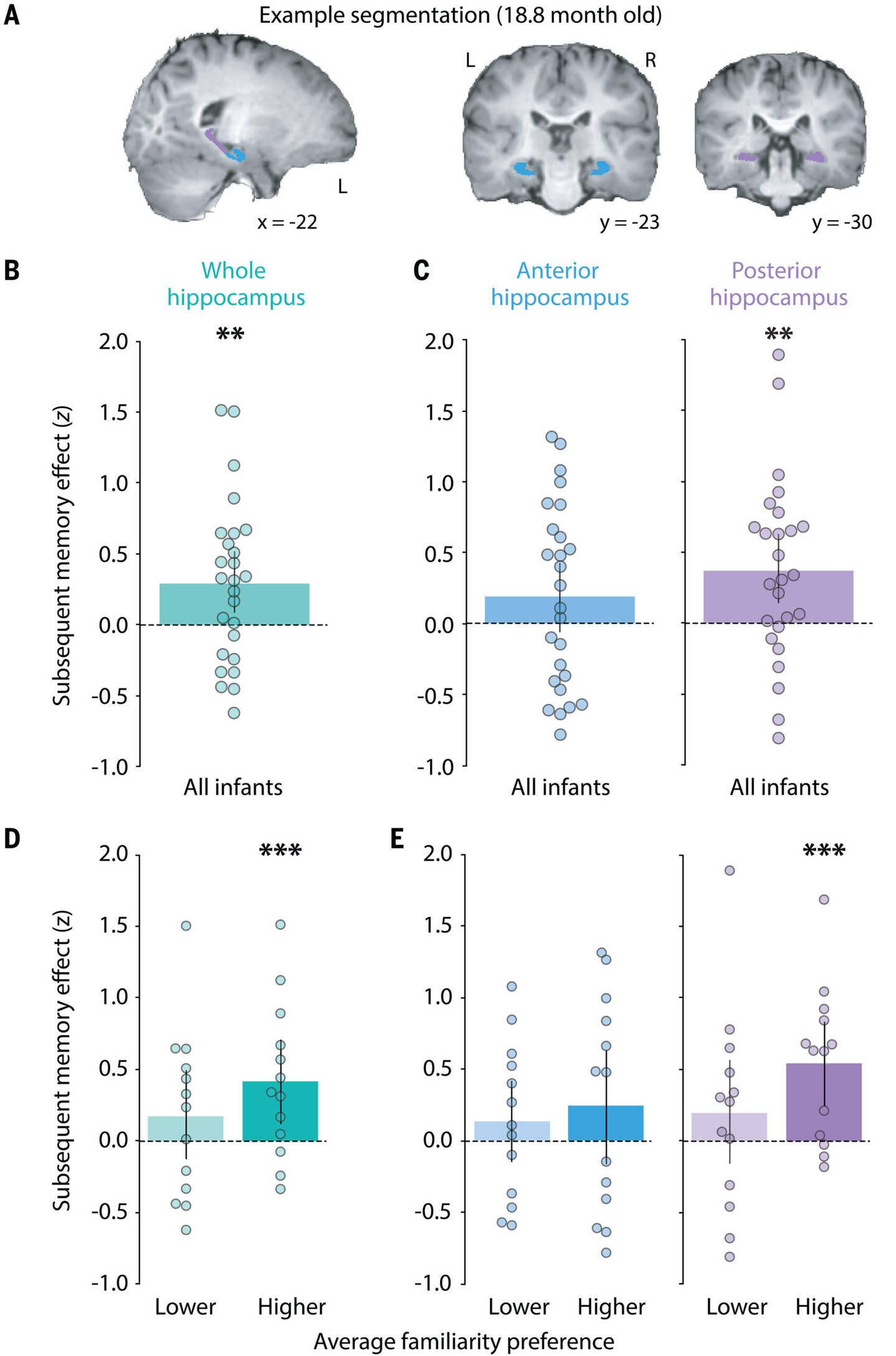 infant-memory-3-scaled Researchers discover why people don’t remember being a baby