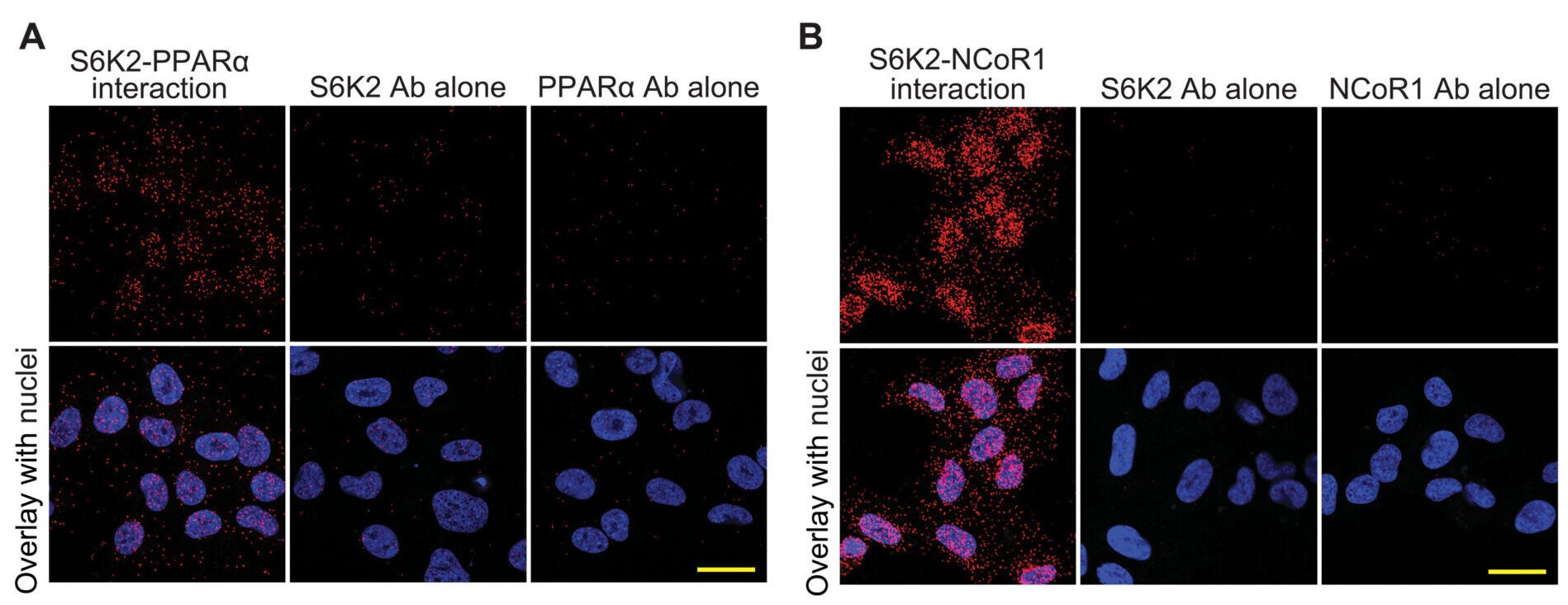 (A and B) Interaction of S6K2 with PPARα (A) or NCoR1 (B) was determined by PLA. Representative images are shown; scale bars, 30 μM.