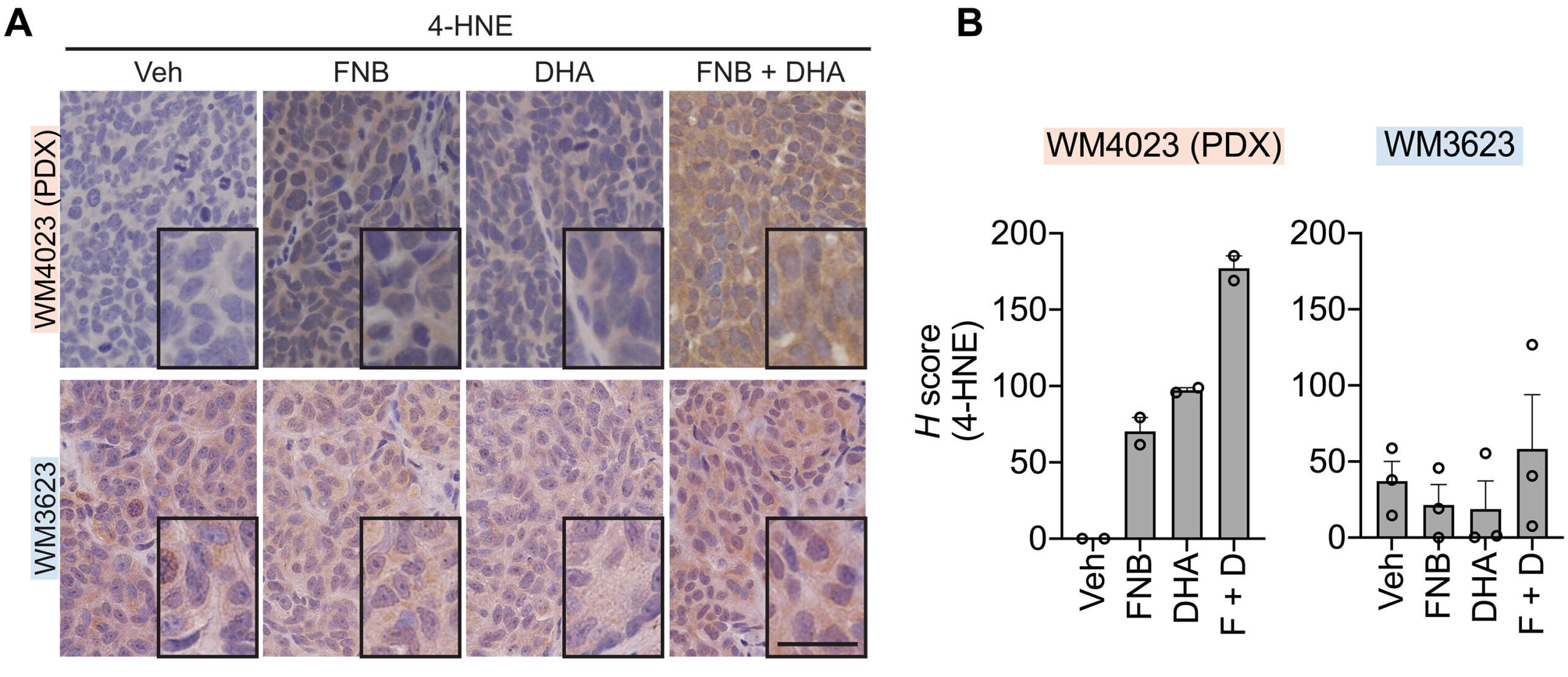 Combined PPARα agonist and PUFA treatment induces lipid peroxidation and oxidative damage in melanoma models.