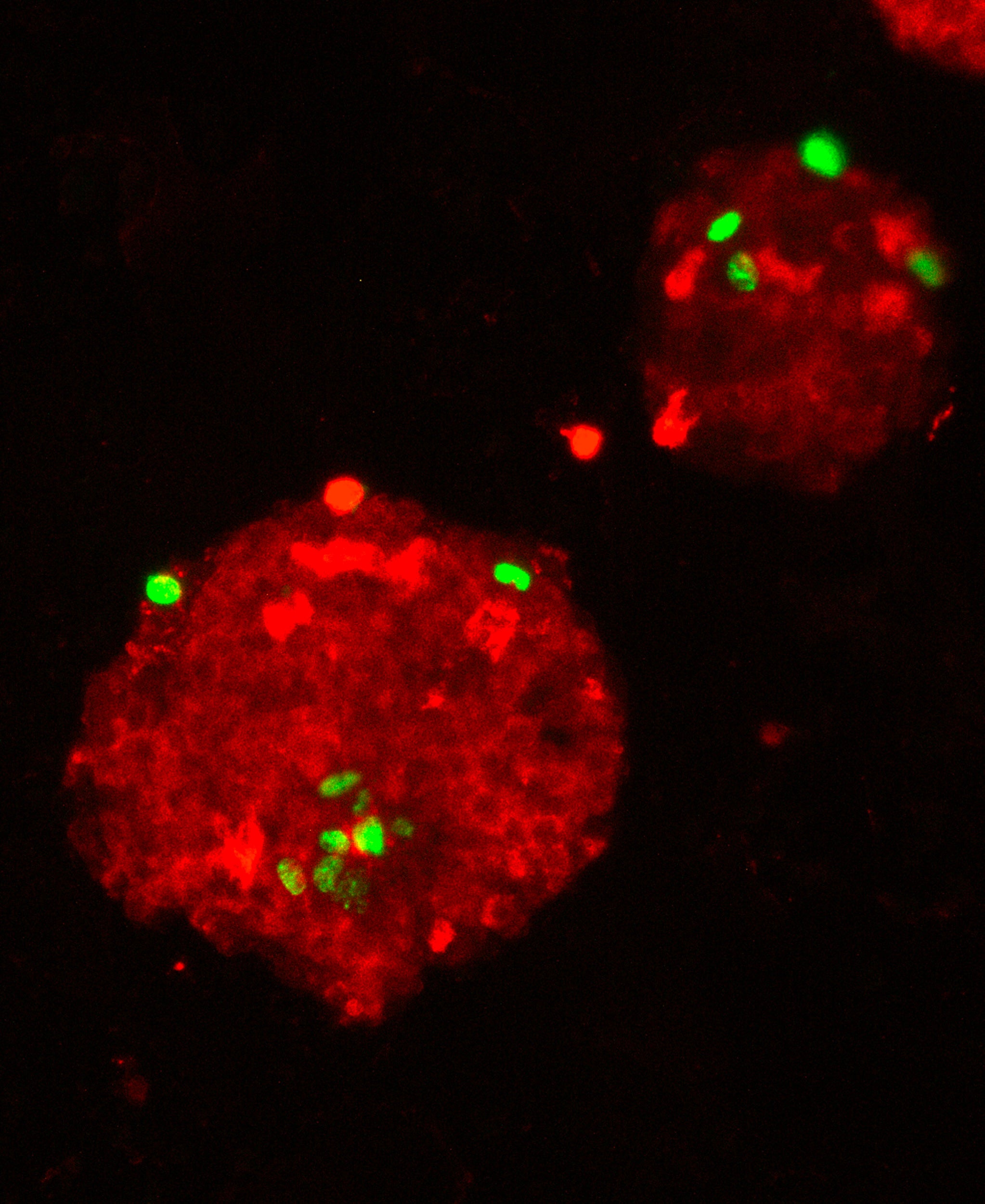 Fluorescent microscope image of a mouse pancreatic islet, the part of the pancreas that makes insulin.