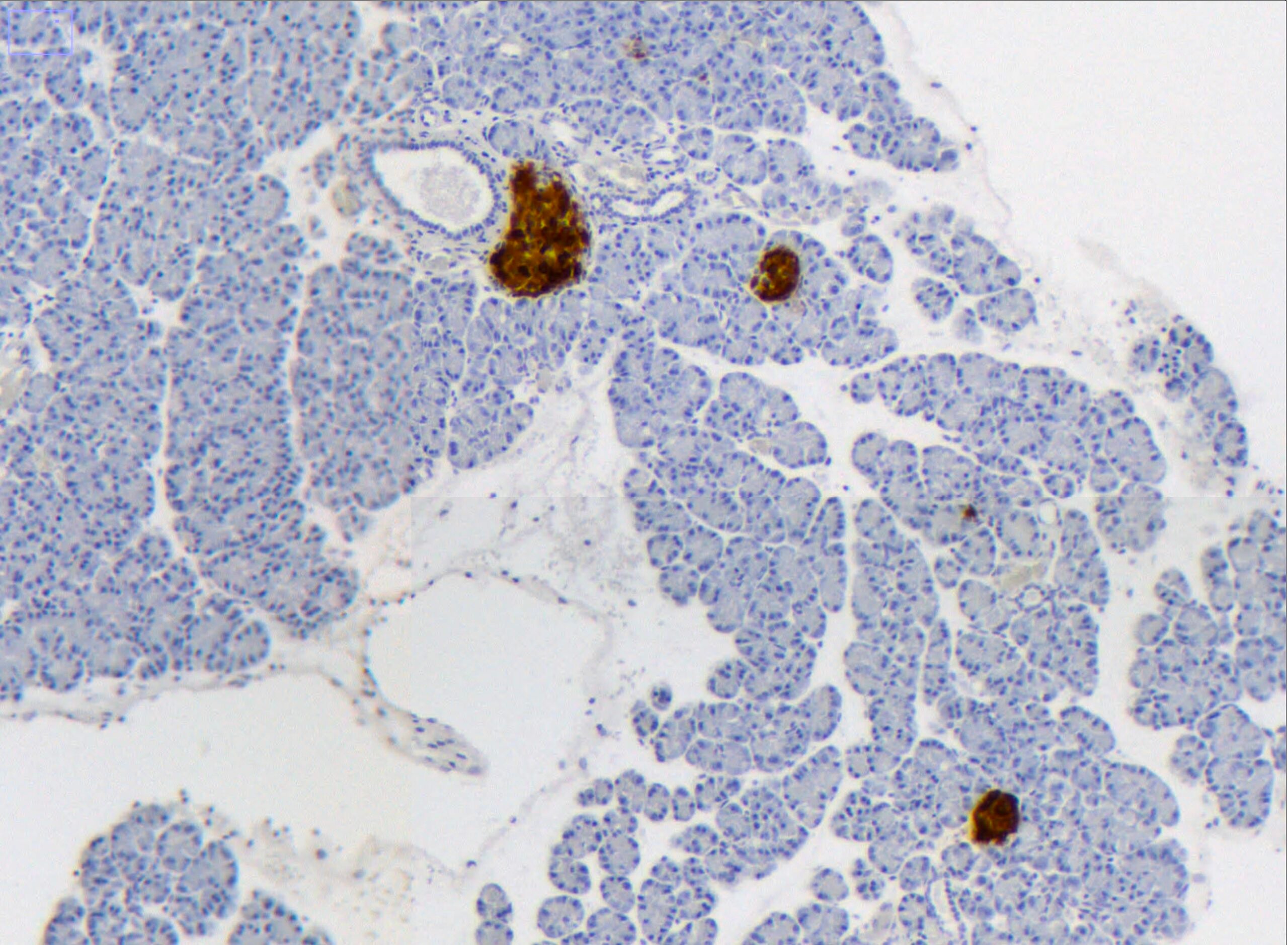 Microscope image of mouse pancreatic tissue, with insulin-producing tissue marked in brown. 