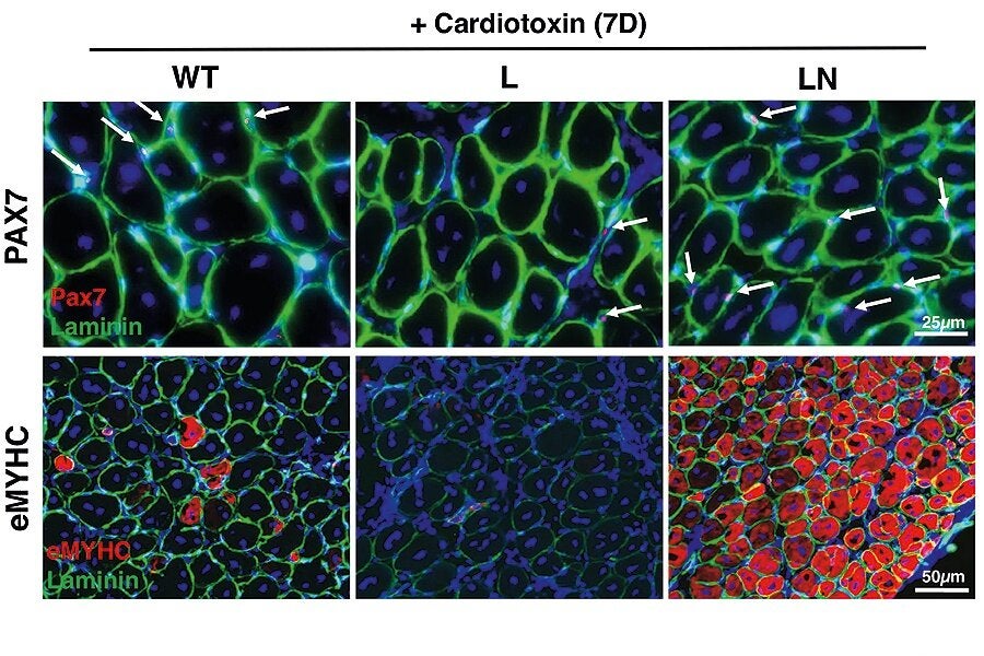 NANOG restoring skeletal muscle regeneration in mouse models. The red in the top three panels is the protein PAX7, and red in the bottom three panels is eMyHC (embryonic myosin heavy chain). The green in all panels in laminin, and the blue in all panels in cell nuclei.