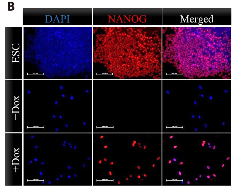 Immunostaining for NANOG expression and nuclear localization upon addition of doxycycline (Dox) in the medium of NANOG transduced human myoblasts and comparison to endogenous NANOG expression in embryonic stem cells (ESCs).