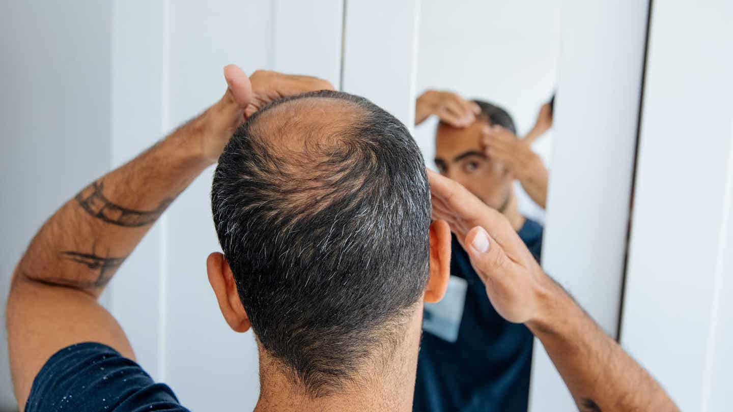 A new study finds that a naturally occurring sugar may regrow hair by boosting blood flow, matching the effects of minoxidil in mice.