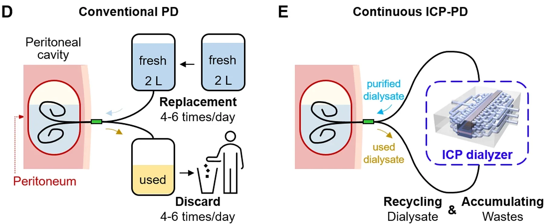 (D) Schematic diagram of conventional peritoneal dialysis (PD). PD uses patient’s own peritoneum, to filter dissolved toxins in a blood with indwelled dialysate for 4 to 6 hours. (E) Schematic diagram of continuous PD using an ICP dialyzer capable of dialysate regeneration.
