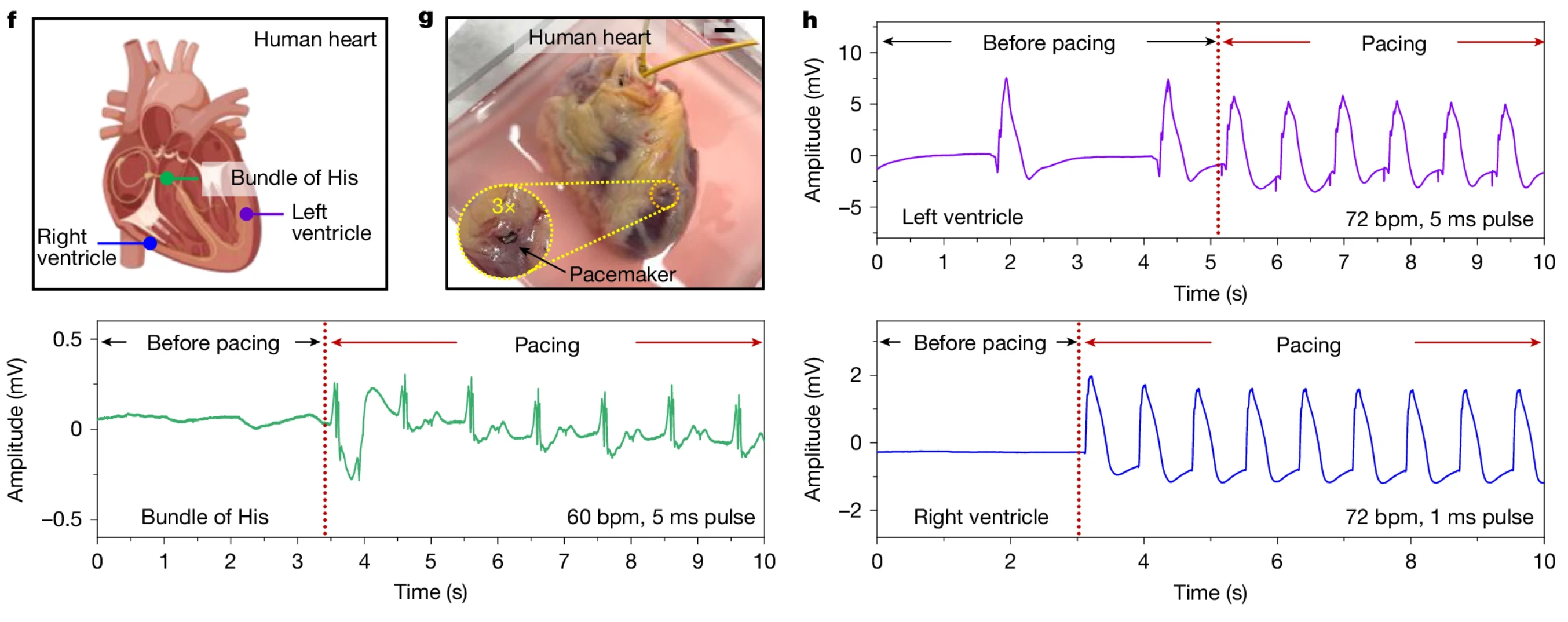 Schematic illustration (f), photograph (g) and ECG results (h) of ex vivo human heart pacing at three different sites: left ventricle, right ventricle and bundle of His. n = 5 biologically independent individuals.