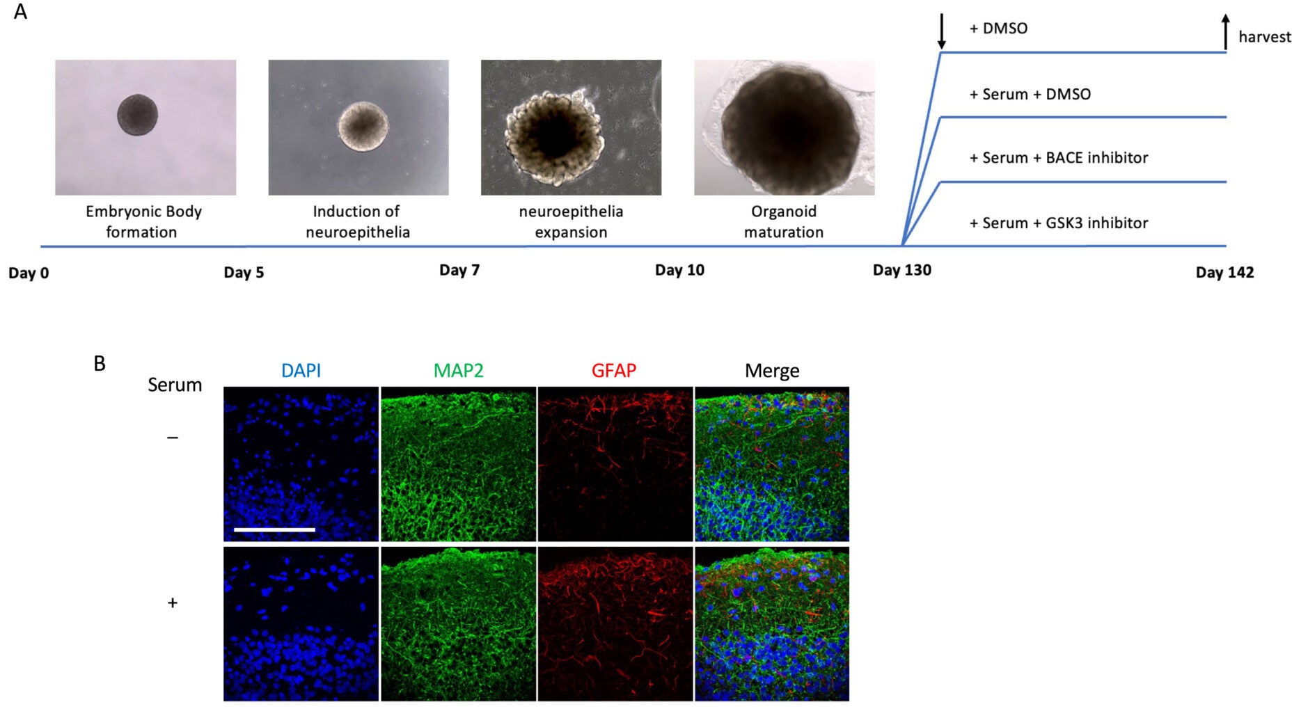 Astrocytic PHGDH expression is elevated in LOAD-BO. A schematic view of the experimental groups.