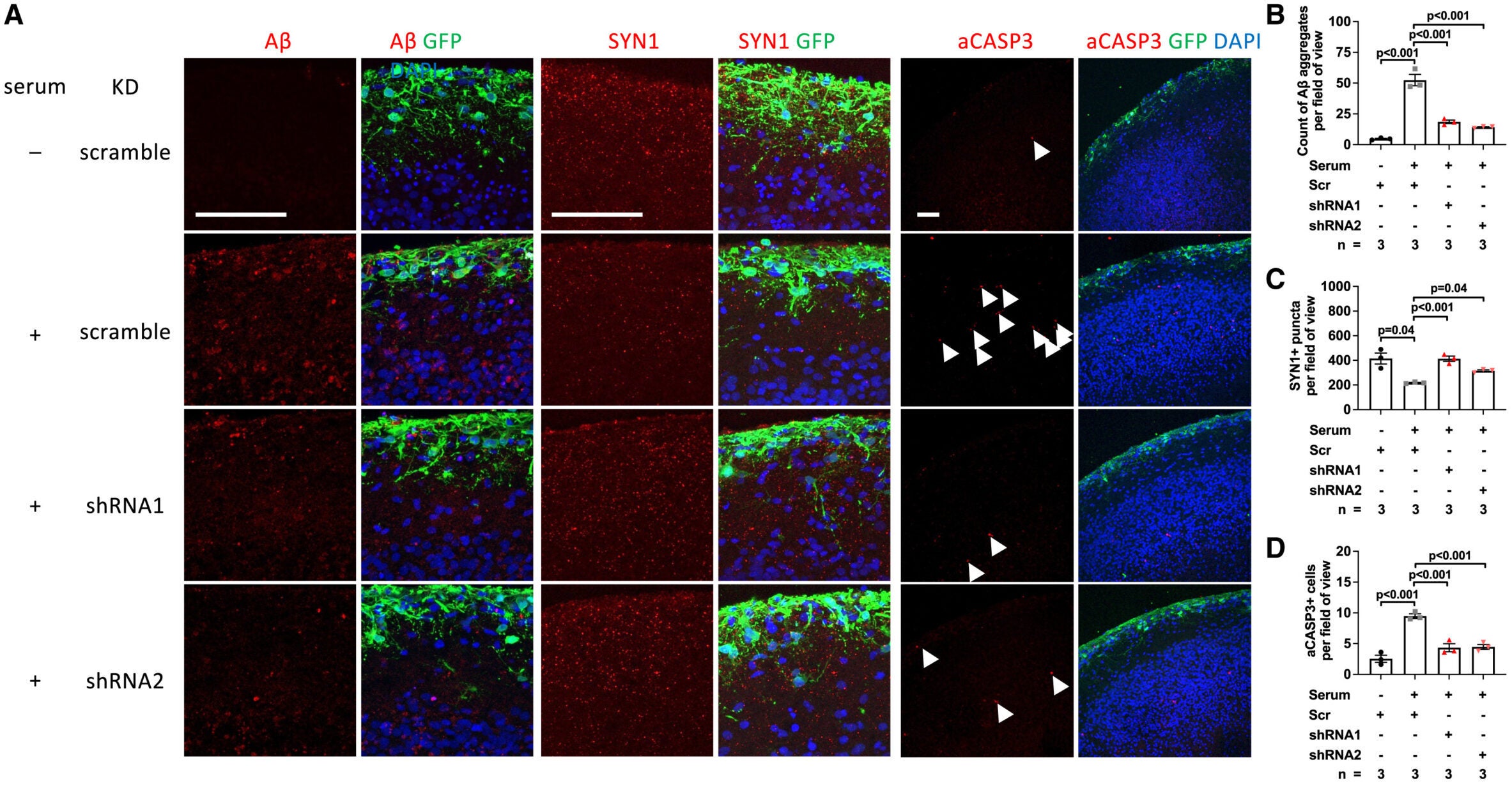 Representative images and quantification of Aβ aggregates, SYN1 puncta, and activated CASPASE-3-positive (aCASP3+) cells in 142-day BOs with and without serum (serum = + and −), with astrocyte-specific KD of PHGDH (KD column) using two shRNAs (shRNA1 and shRNA2) and a scramble control (Scr).
