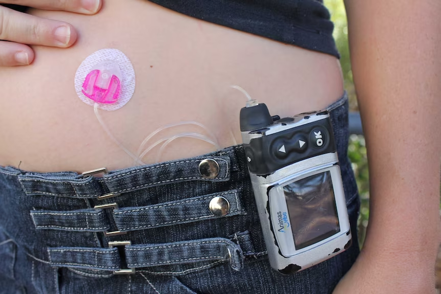 Researchers say the breakthrough could lead to an alternative treatment to regular insulin injections. 