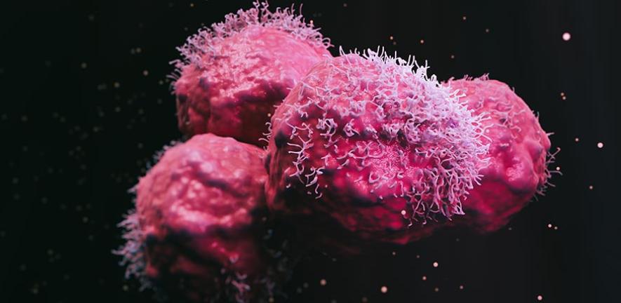 Close-up of cancer cells.