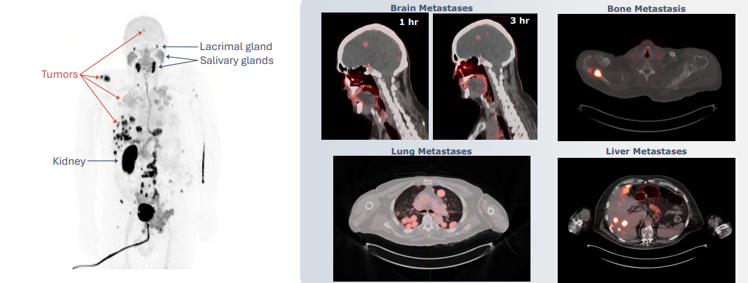 Maximum intensity projection (MIP) image and all axial PET/CT fusions at 1-hour timepoint except as noted.