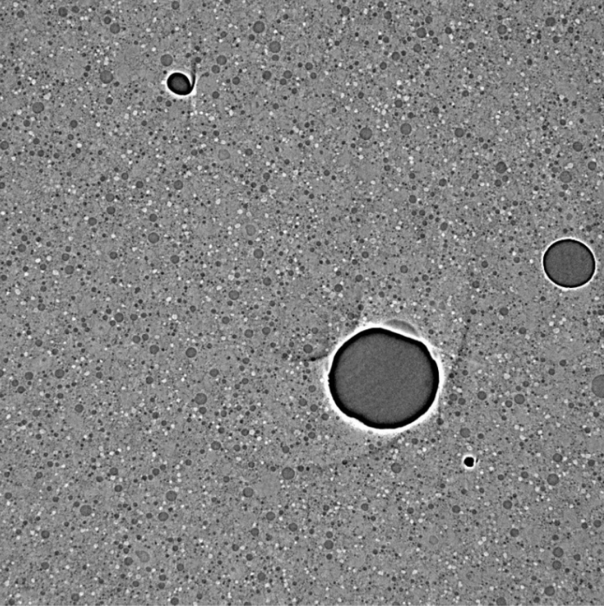 Ortho CT Slice of PP1, differences in grey values can been observed and correlate to difference in density to be used in histogram analysis.