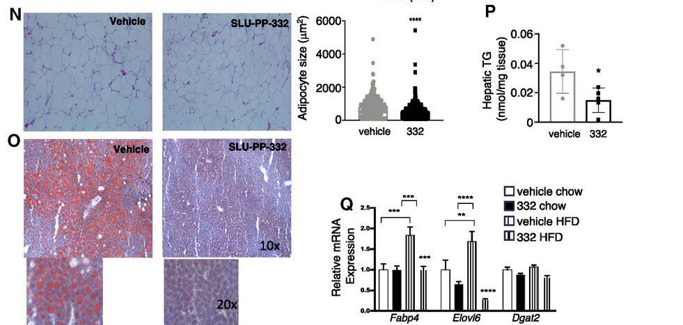 SLU-PP-332 increases fatty acid metabolism in a DIO mouse model.