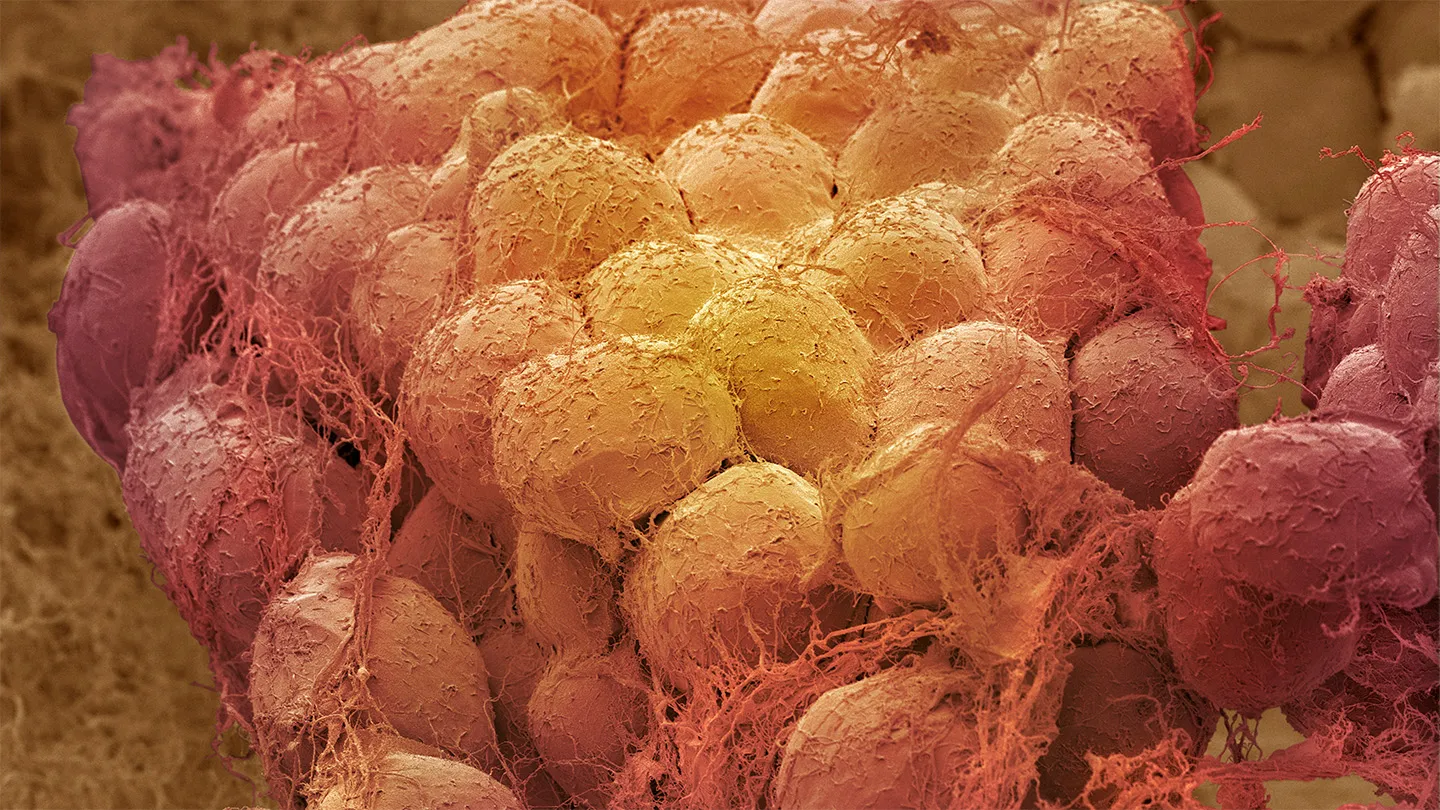 Adipose tissue, which contains fat cells (shown red-yellow in this scanning electron micrograph)