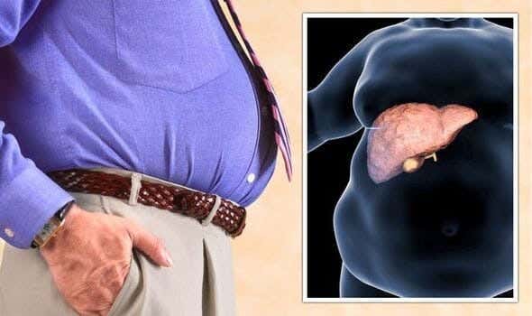 NAD+ Restoration Found to Protect Liver from DNA Damage