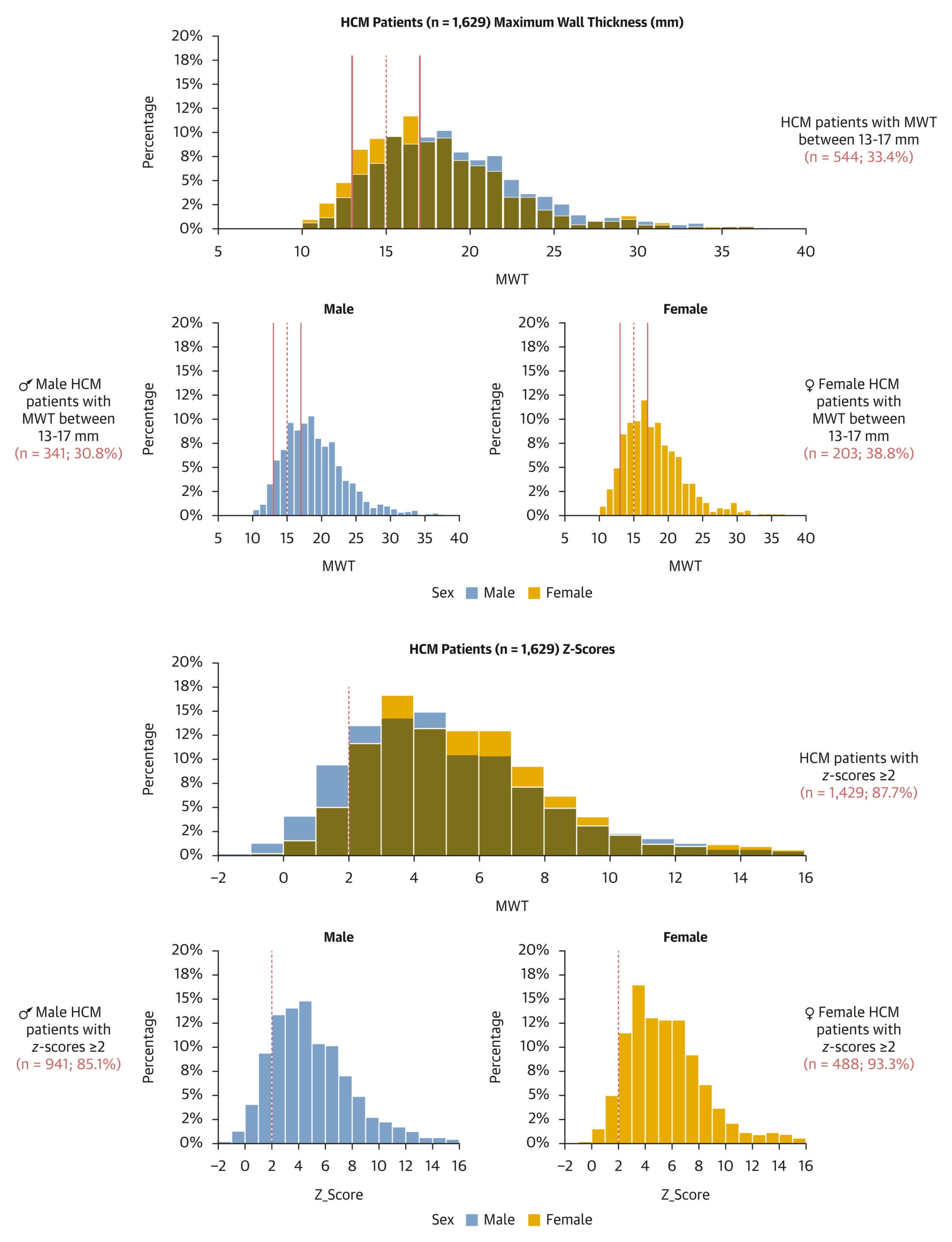 Distribution of MWT and z-Scores of Patients in HCM Cohort HCM = hypertrophic cardiomyopathy; MWT = maximum wall thickness.