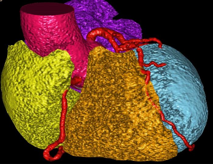 AI can be used to identify different cardiac segments in CT scans, such as left and right atria, left and right ventricle and cardiac arteries. AI also integrates patient biometric data, allowing physicians to more precisely predict cardiovascular risk.