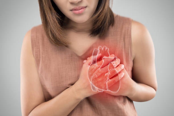 Heart disease is the top killer of women in the United States.