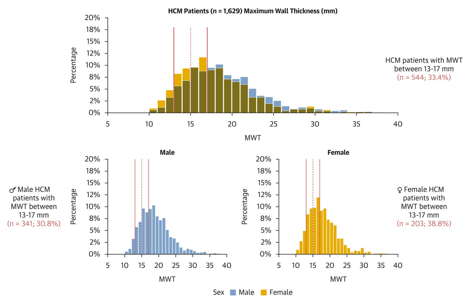 Distribution of MWT in HCM Cohort HCM = hypertrophic cardiomyopathy; MWT = maximum wall thickness.