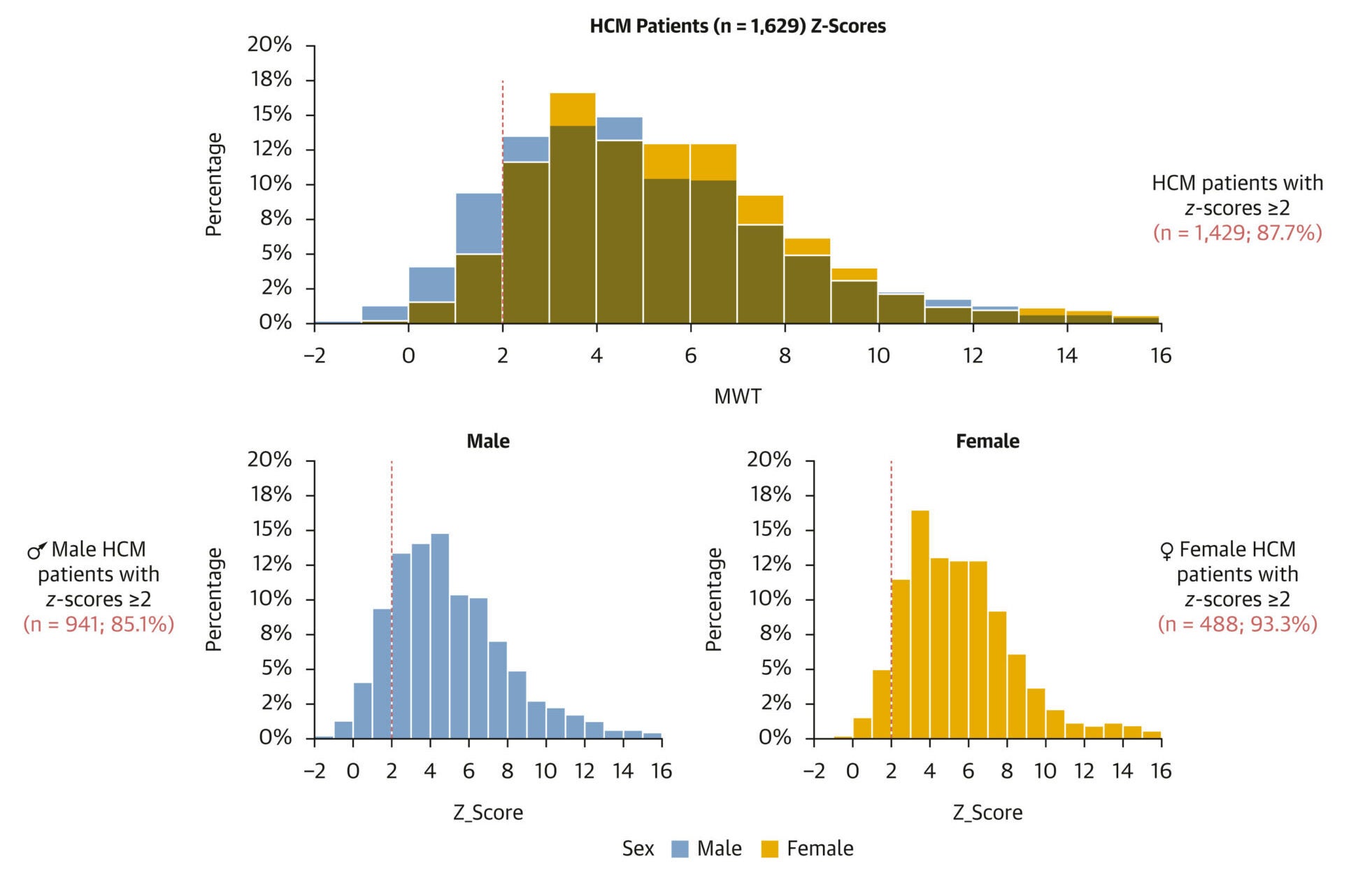 Distribution of z-Scores of Patients in HCM Cohort HCM = hypertrophic cardiomyopathy; MWT = maximum wall thickness.