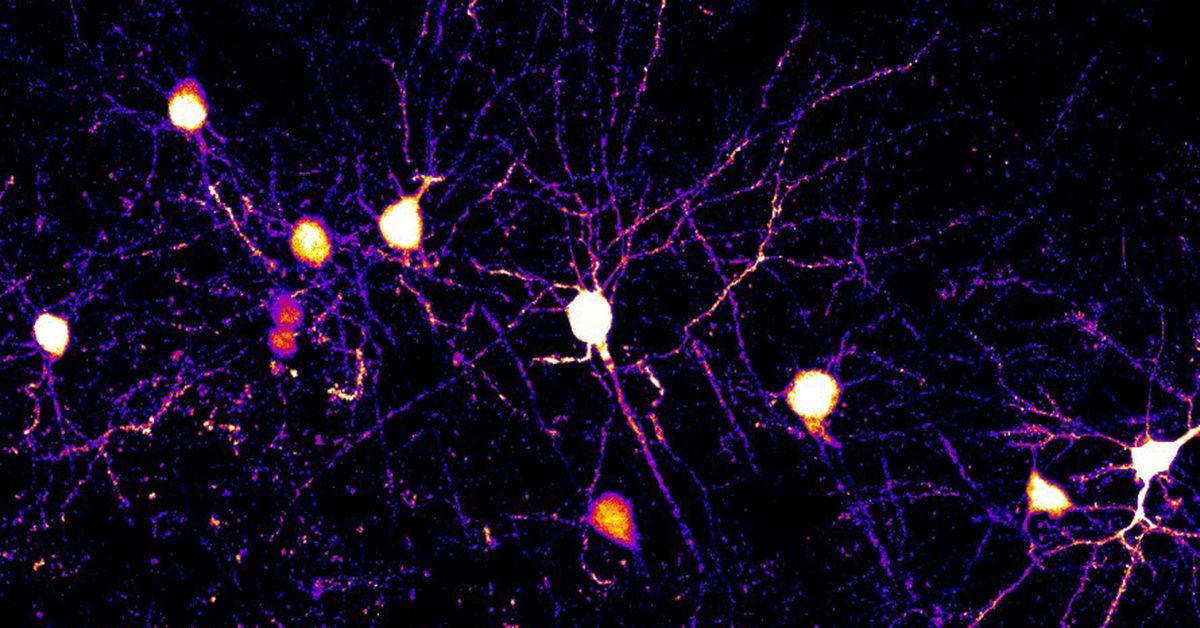 Groundbreaking learn about solves the thriller of the way our mind learns