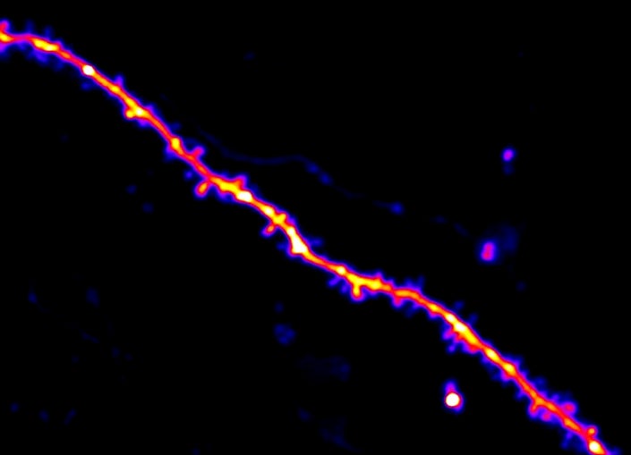 As mice learned a new behavior, researchers closely tracked synaptic connections (depicted here as small protrusions) on the dendrites of neurons.