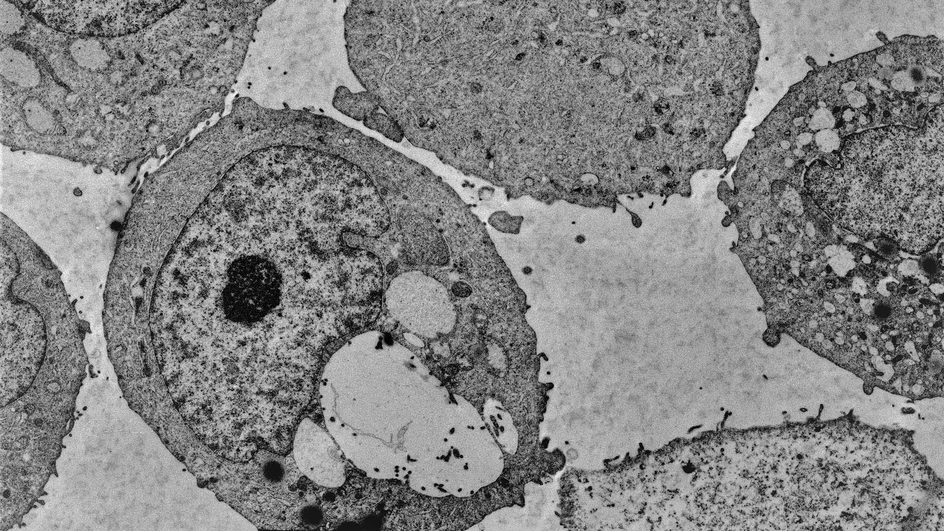 A new study from Cold Spring Harbor Laboratory Professor Lloyd Trotman and colleagues, published in Science, shows that menadione significantly slows prostate cancer growth in mice and in human-derived cancer cells.