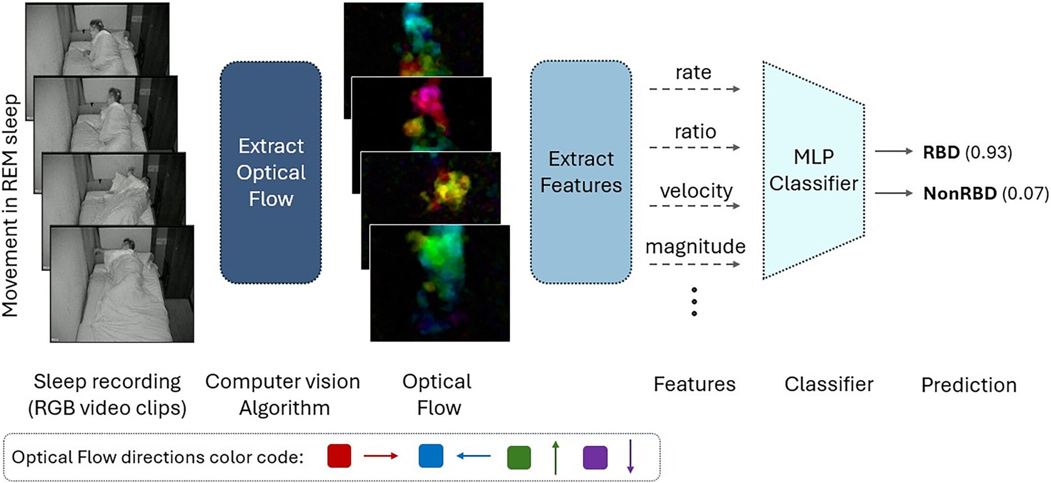Overview of the study method. The pipeline starts with trimming the segments featuring REM sleep (vPSG manually scored) from the patient's sleep recording. Next, researchers used an optical flow algorithm to trim the movement segments based on the motion area and intensity from the RGB video clips. The color represents the direction of the flow vector. 