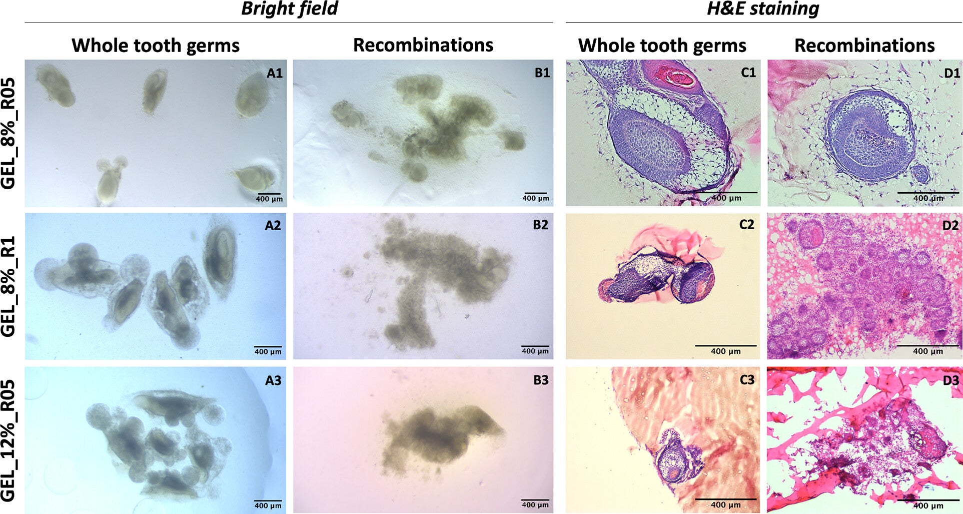 Whole tooth germs and recombination of dental mesenchymal and epithelial cells in bioorthogonally cross-linked hydrogels prepared by varying polymer concentrations and stoichiometric ratios.