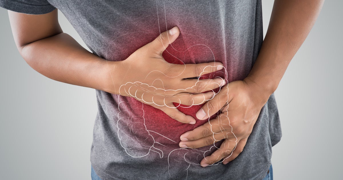 Swallowed sensor offers real-time gut monitoring for over 3 million IBD patients in the U.S., detecting mucosal damage before symptoms worsen.