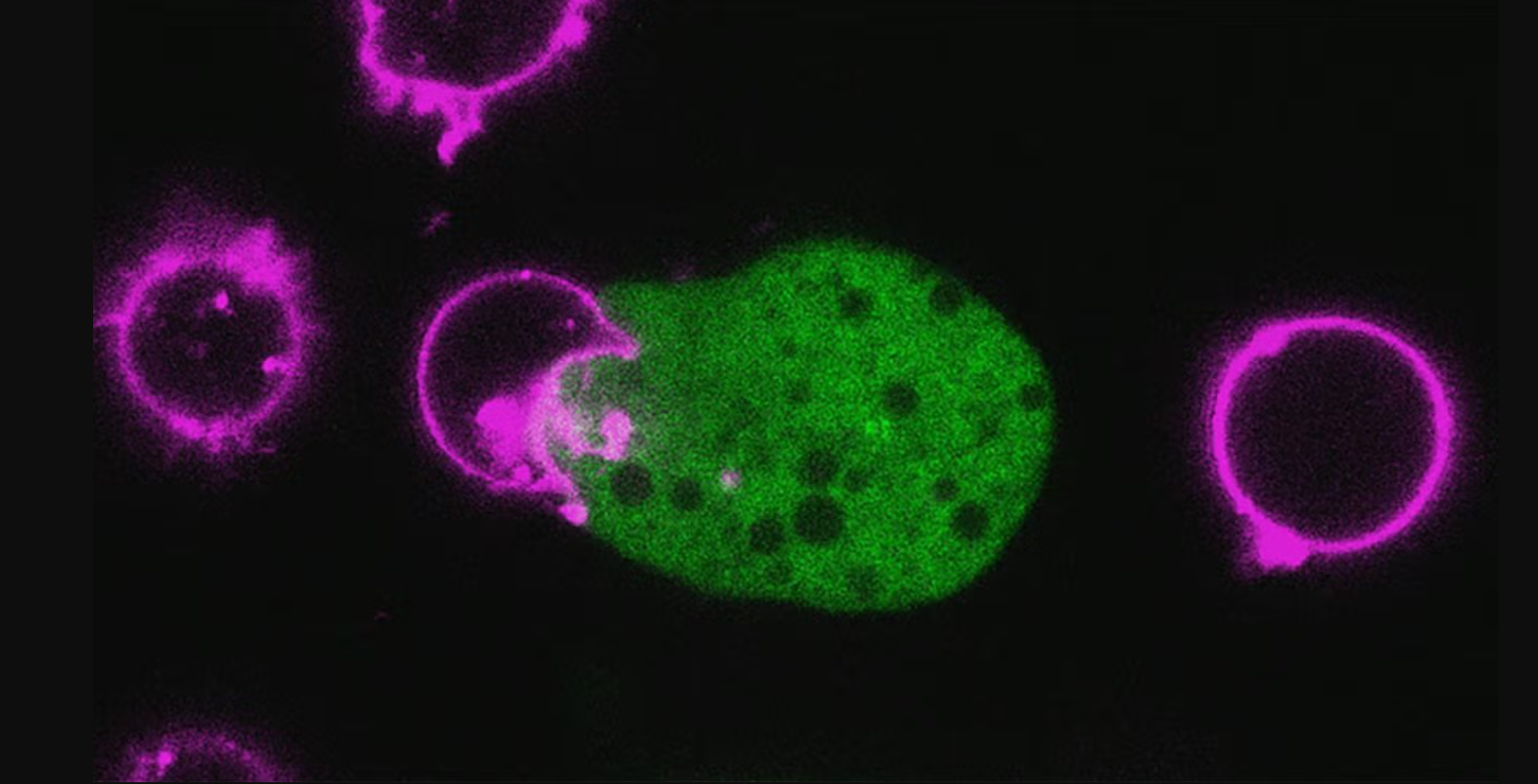 Entamoeba histolytica is a single-cell parasite that causes intestinal disease, but sometimes invades the body, attacking cells and creating liquefying abscesses. UC Davis parasitologist Katherine Ralston has studied the genome of Entamoeba and now proposes a strategy to learn how it attacks human cells and evade the immune response. Image shows E. histolytica (green) attacking human T-cells (white blood cells).