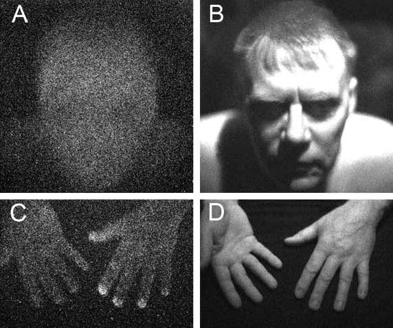 Ultra-weak photon emission of the face, the palm and dorsum of the hand.