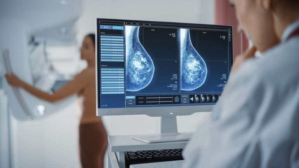 AI could detect interval breast cancers missed by radiologists