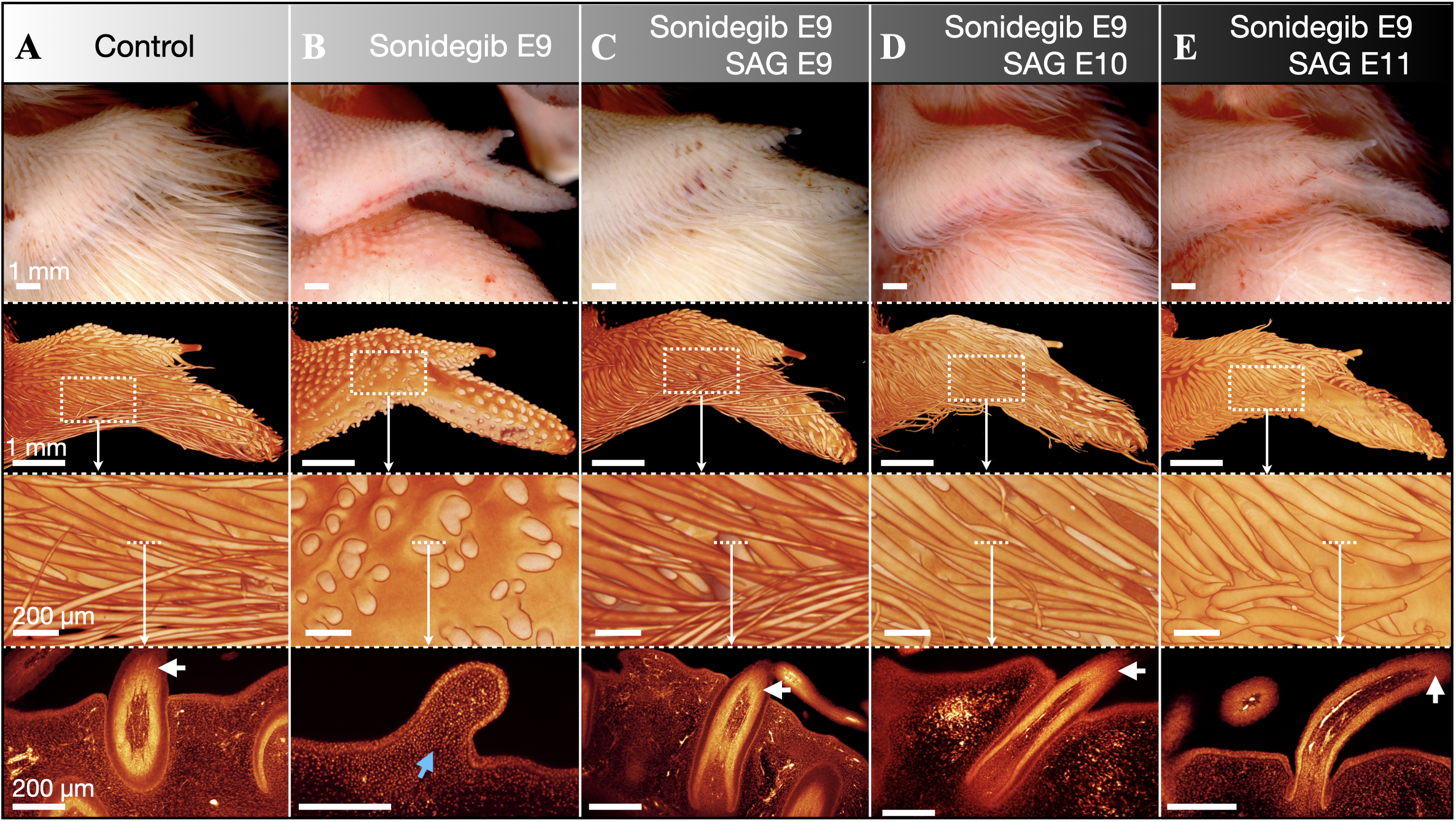 SAG treatment rescues sonidegib-perturbed feather morphogenesis at E14.