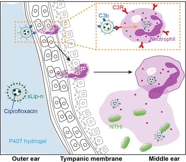 Schematic illustration of the active transtympanic delivery of negatively charged liposomes.