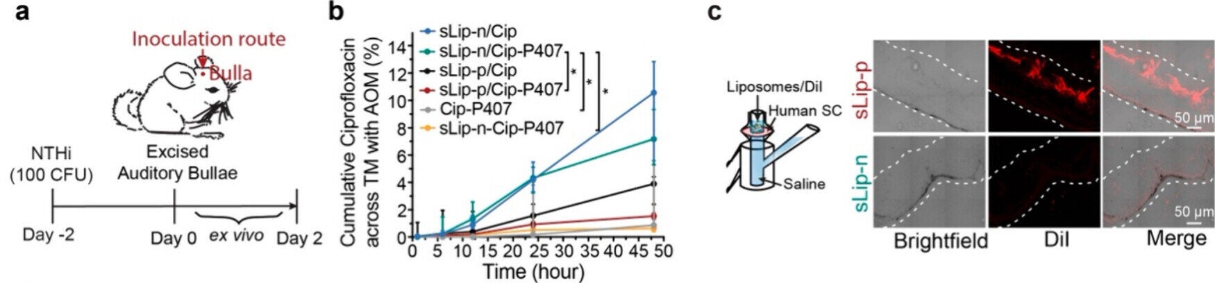 Diagram of the Franz diffusion cell to evaluate the permeation ability of liposomes to cadaver stratum corneum