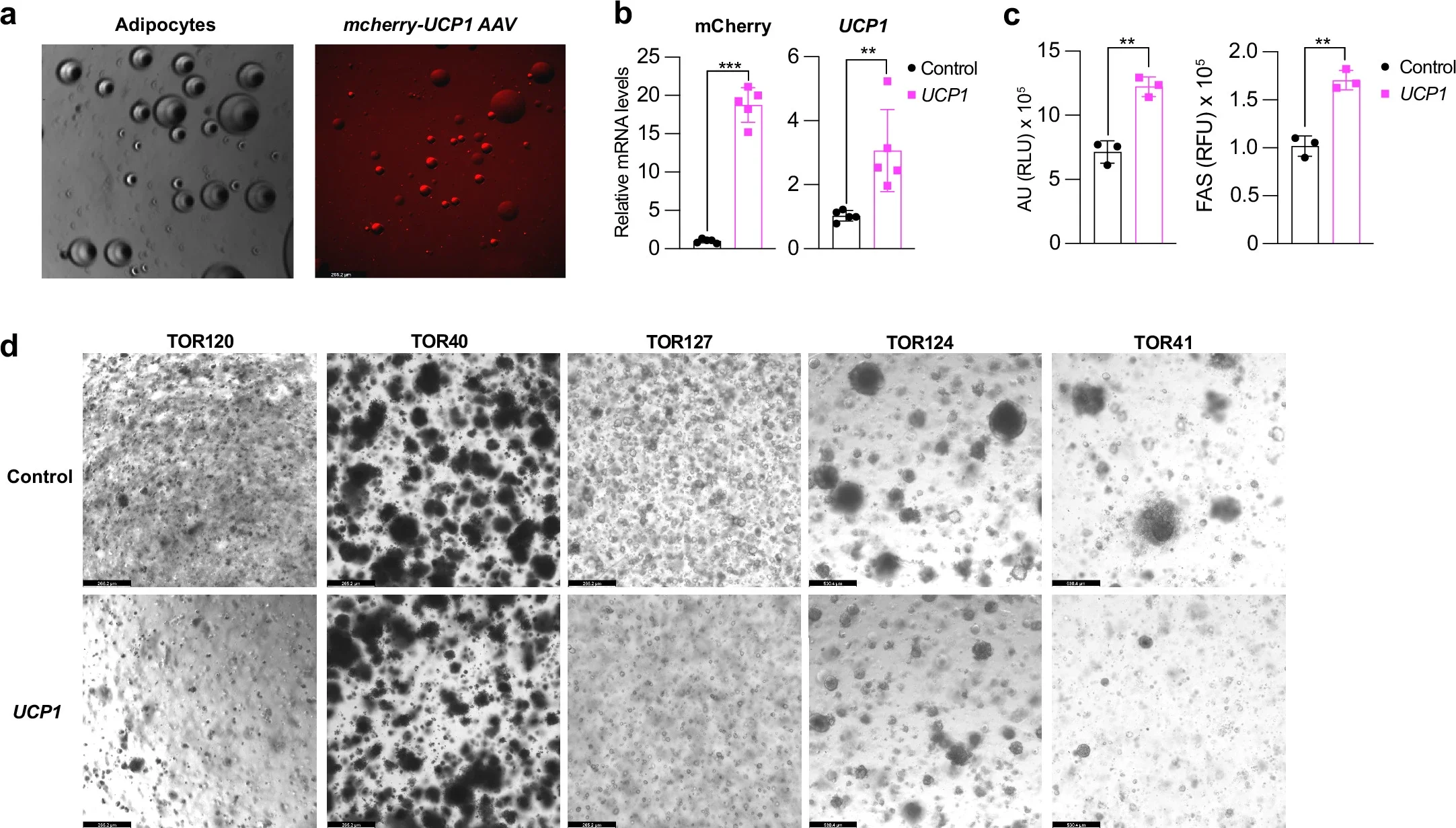 CRISPRa upregulation of UCP1 in human mammary gland adipocytes.