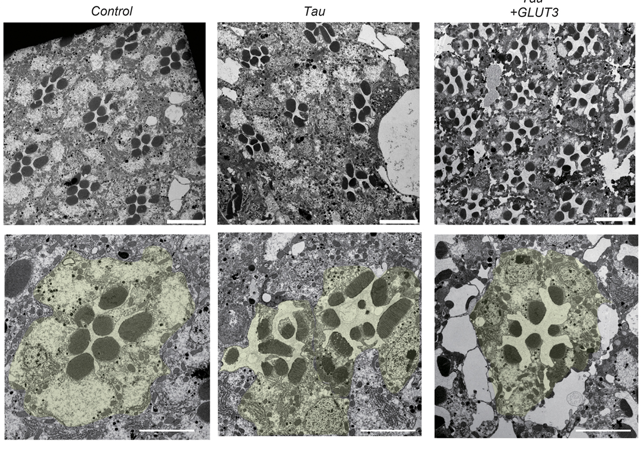 Representative TEM images of eye photoreceptors in flies as indicated. GLUT3 coexpression mitigated rhabdomere distortion (yellow) in the eyes of flies expressing Tau. 