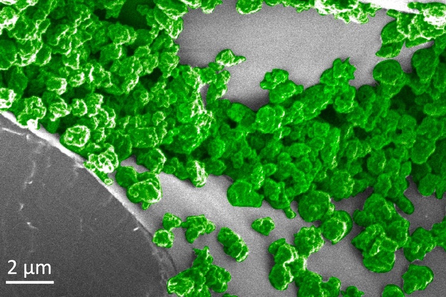 MIT engineers have developed an innovative light-emitting plant by incorporating specialized nanoparticles into plant leaves, which can be charged using an LED. In this image, the green areas represent the nanoparticles that have accumulated on the surface of the spongy mesophyll tissue inside the plant leaves.