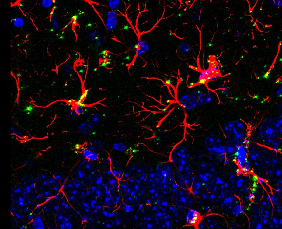 Rodent hippocampal astrocytes (in red) overexpressing hevin (in green).