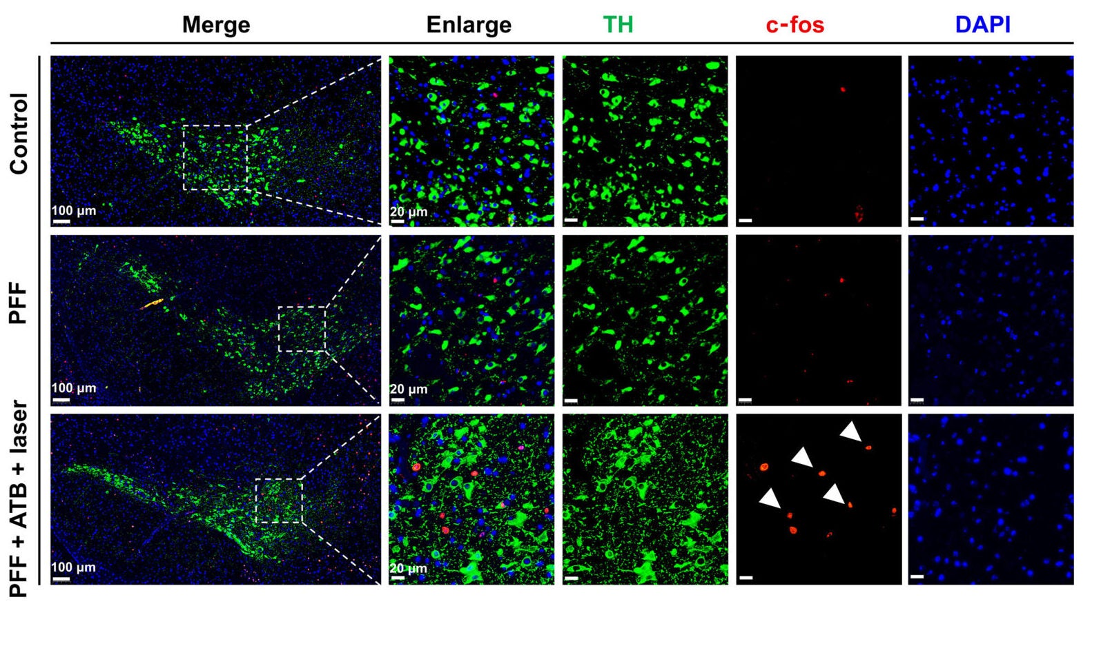 ATB NPs in the SN induce the activation of DA neurons and DA release in mice.