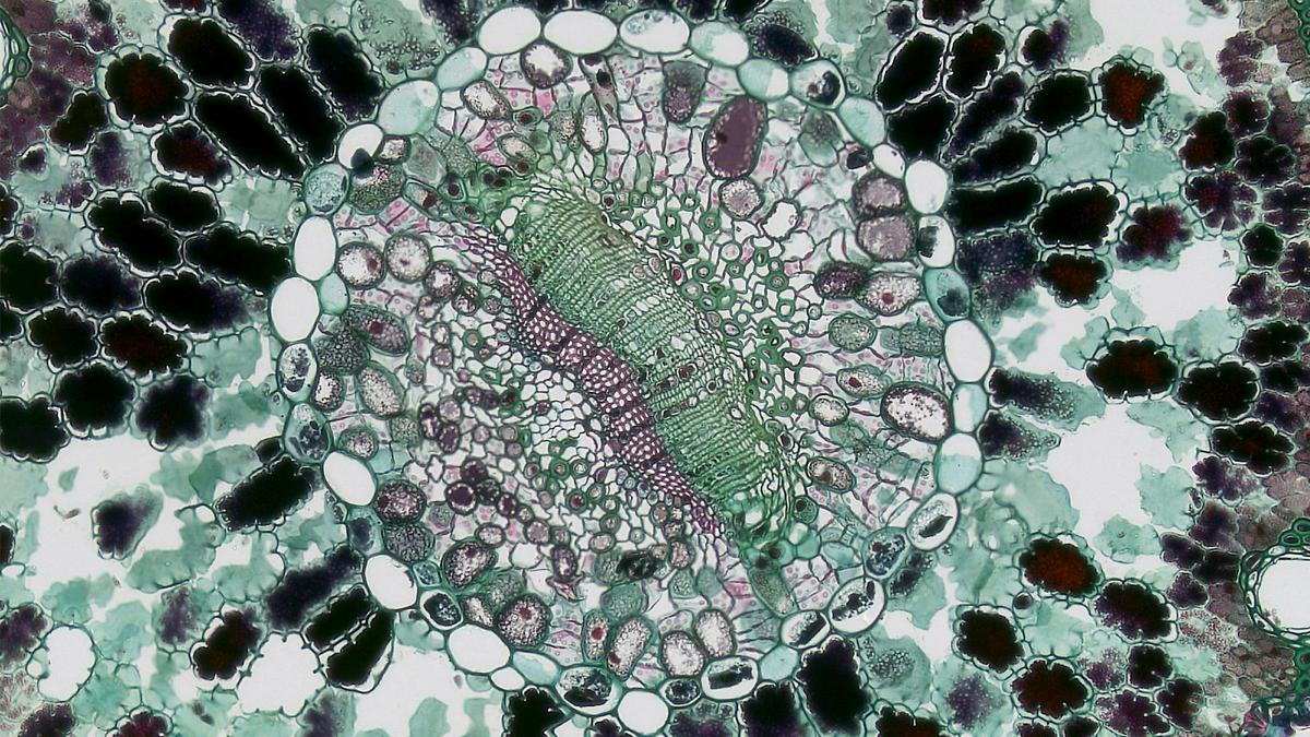 A cell seen under microscope. 